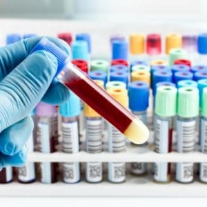 Investigando el vínculo entre el tipo de sangre y el riesgo de COVID-19
